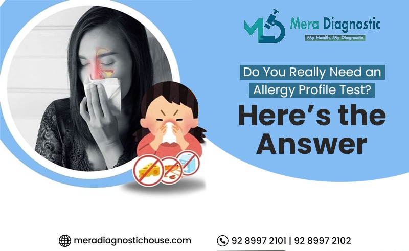 Allergy profile test